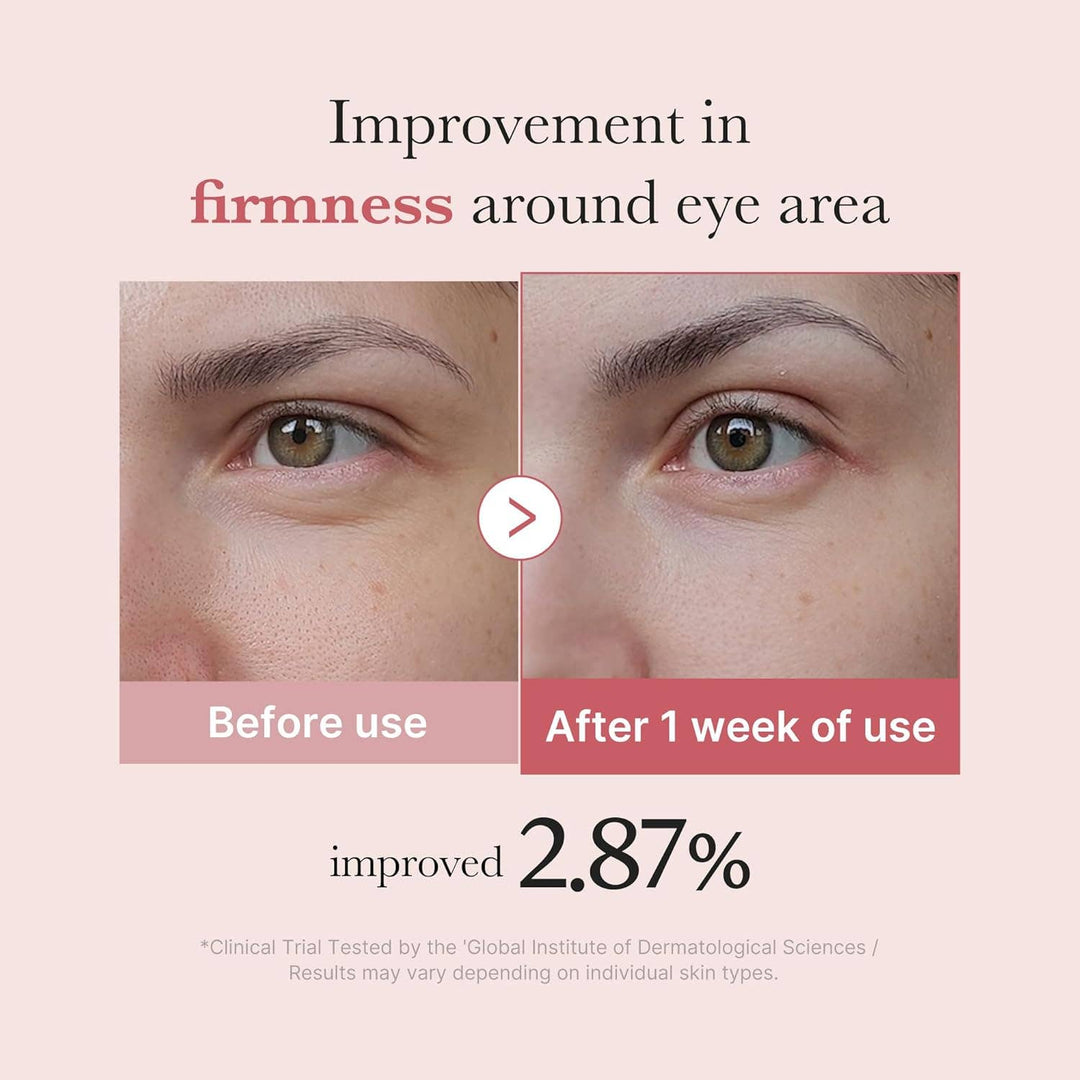 Medicube Eye Cream 1oz-Salmon DNA PDRN Pink Peptide Eye Cream