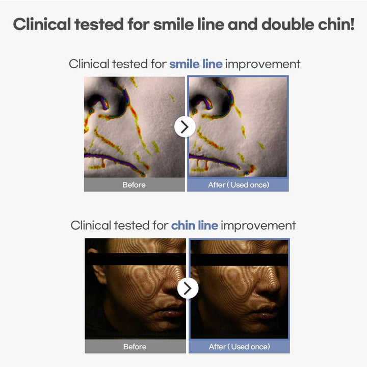 AVAJAR Rejuvenating Double V Mask-5 Sheets