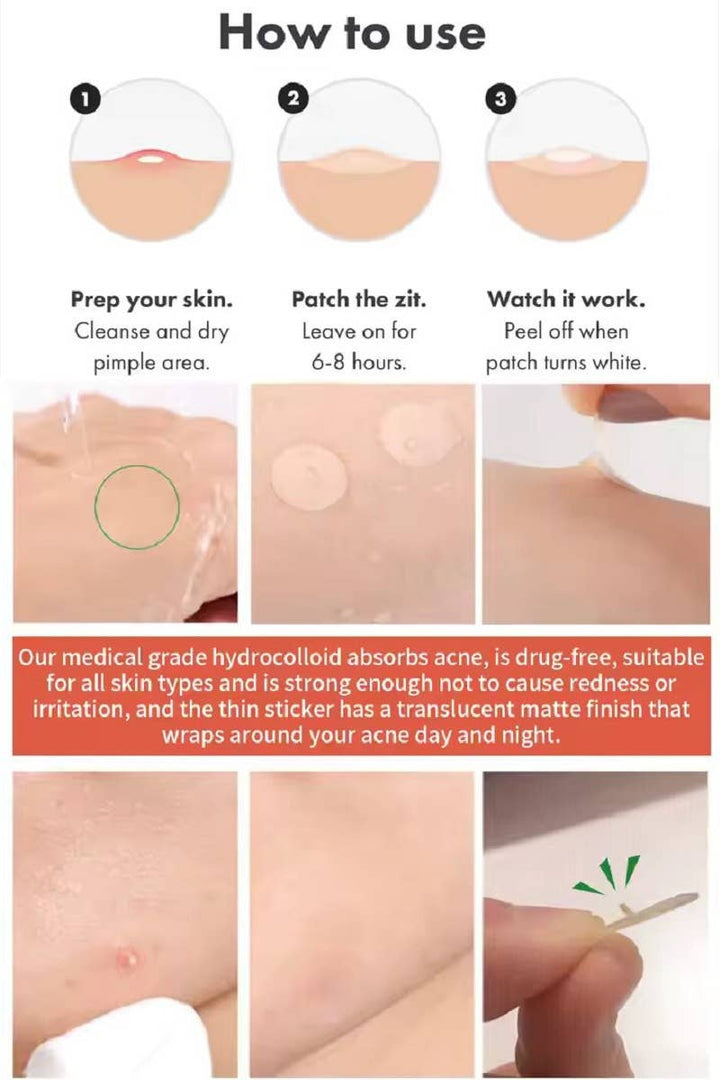 The Original Hydrocolloid Acne Pimple Patch-Box of 36
