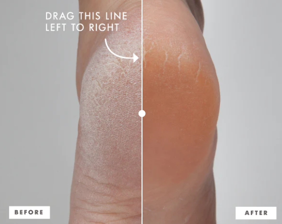 Mask-Foot Rescue Enrich Mint