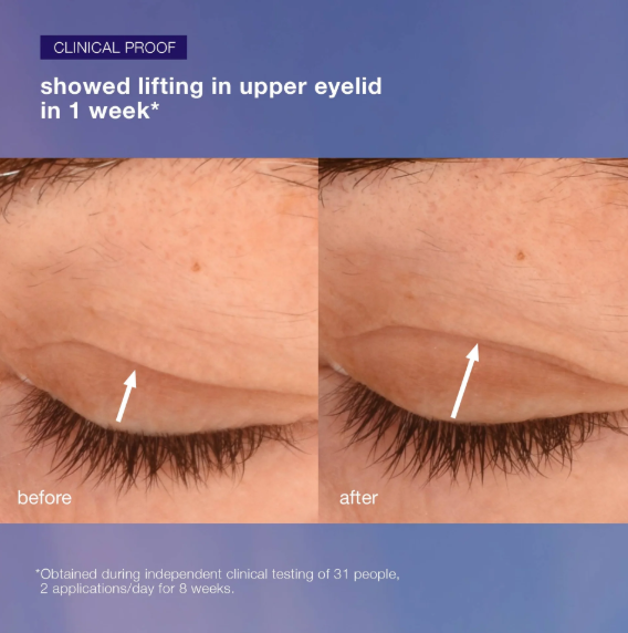 Phyto Nature Lifting Eye Cream .5oz