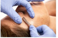 Dermaplaning With Customized Facial