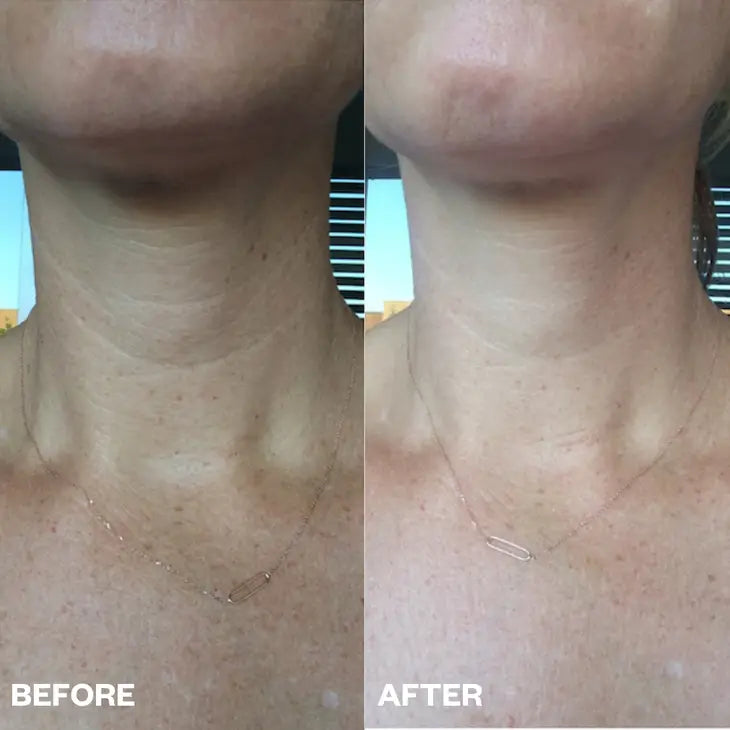 Neck Wrinkle Patches